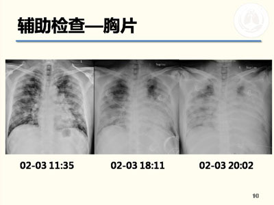 北京青年呼吸学者沙龙2016年第4次活动